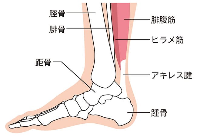 【後ろから叩かれたような衝撃】アキレス腱断裂（あきれすけんだんれつ）